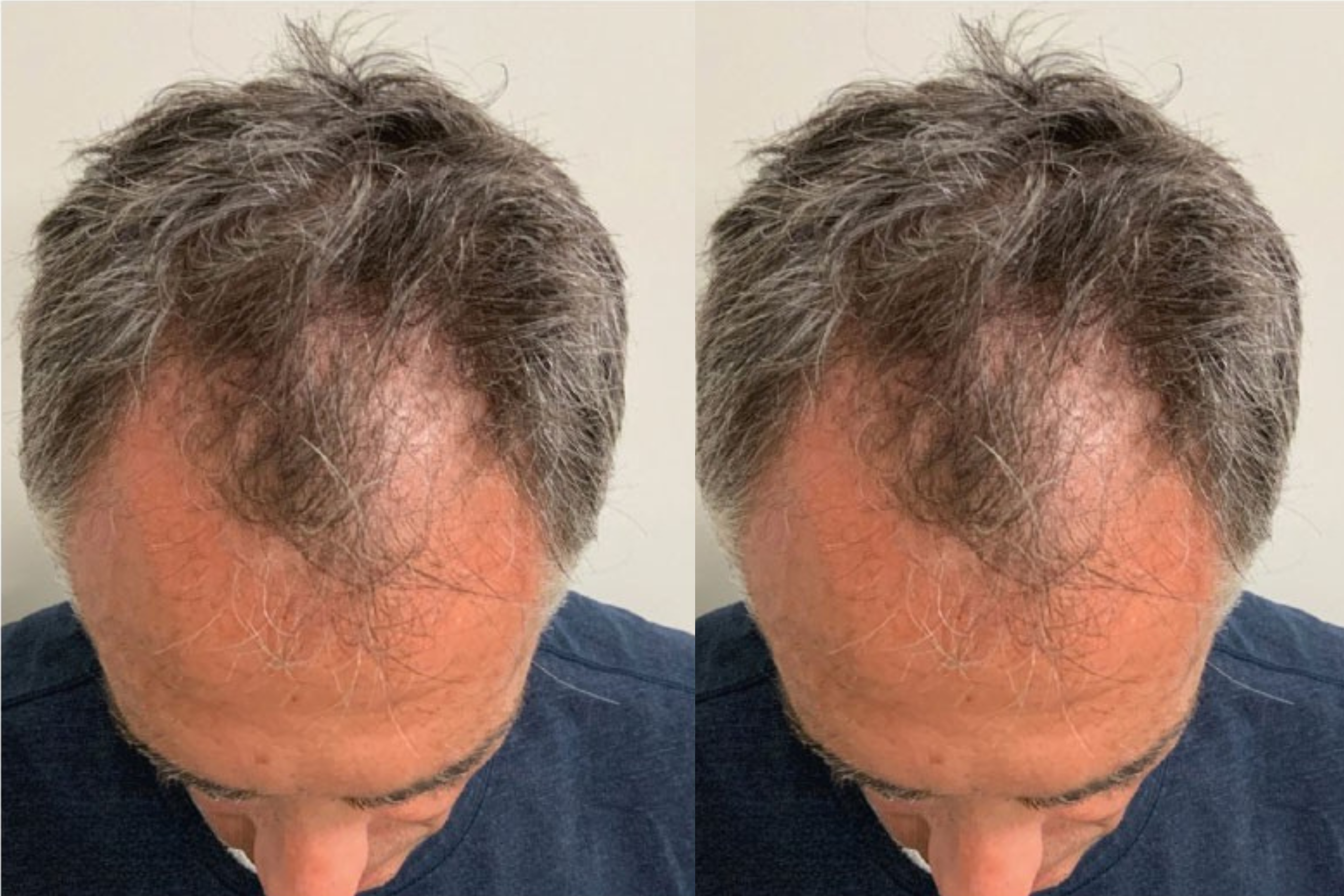 Before image