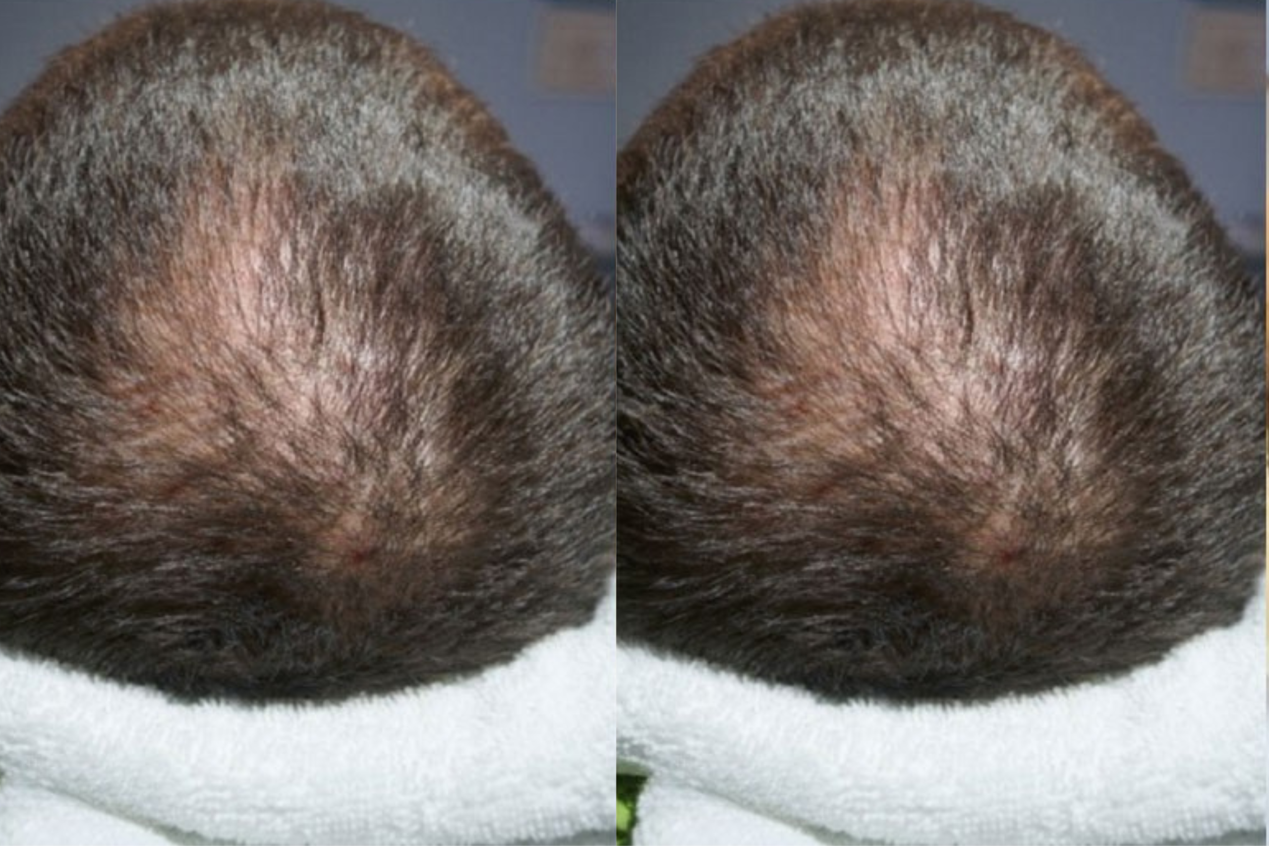 Before image