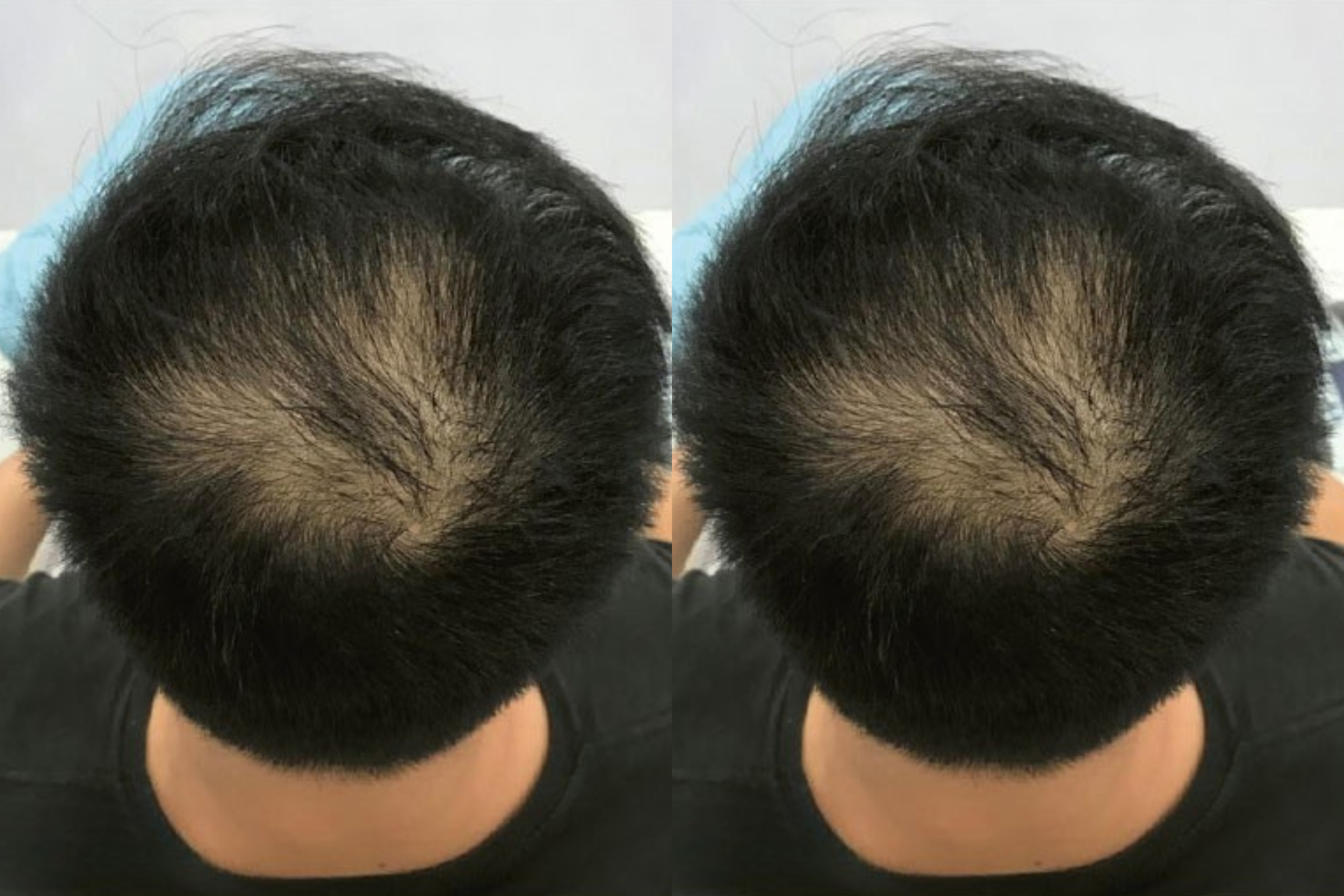 Before image