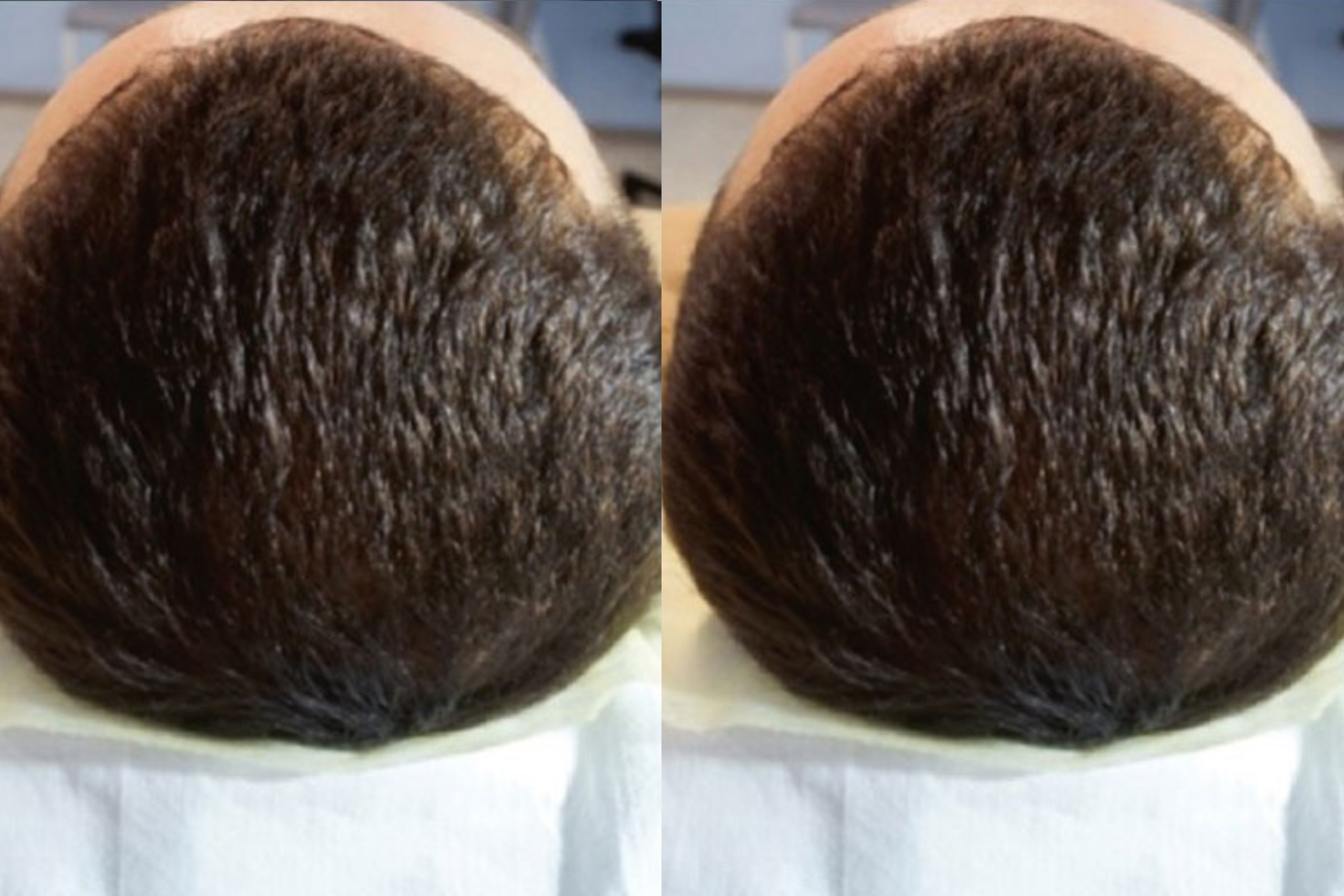 After image