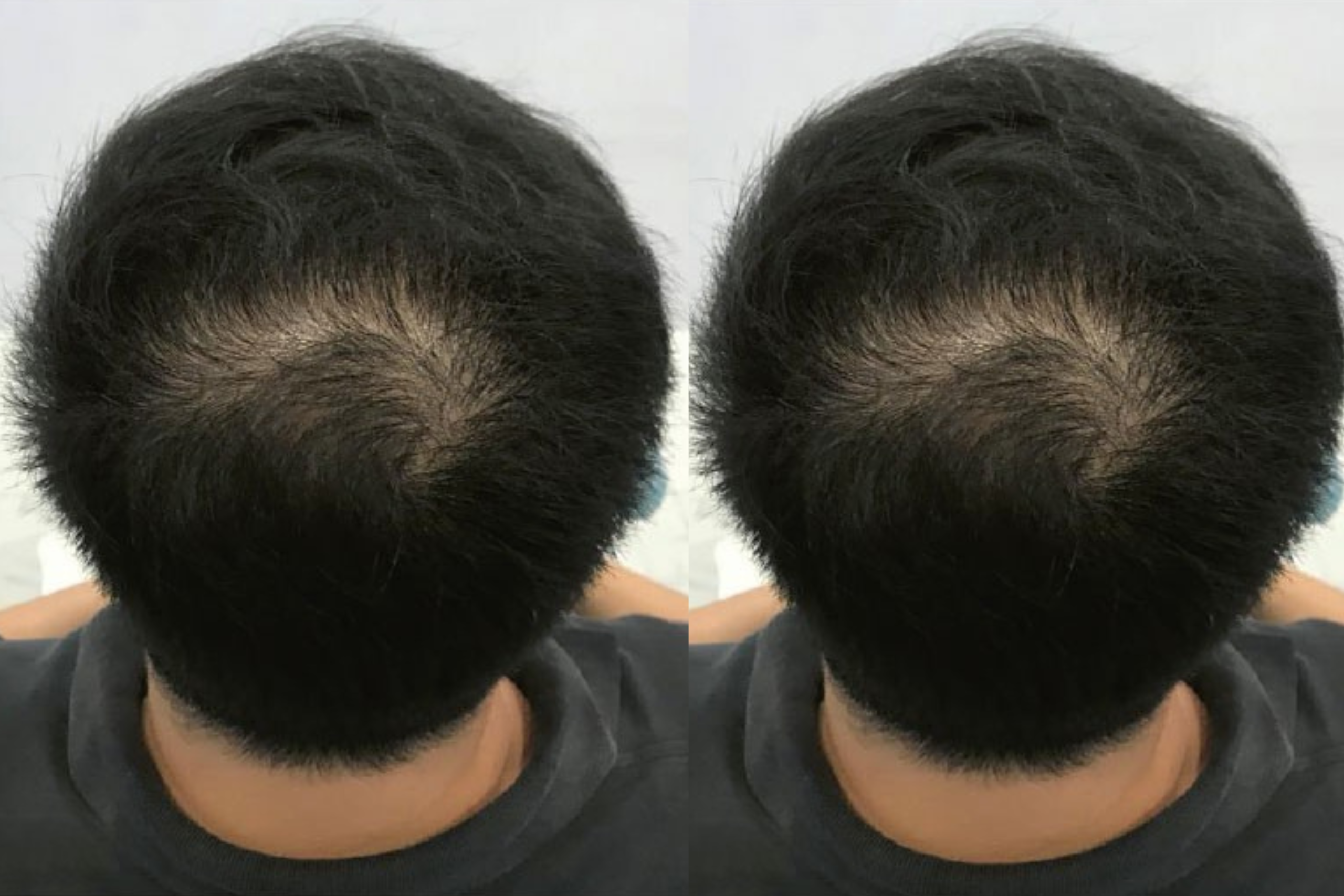 After image