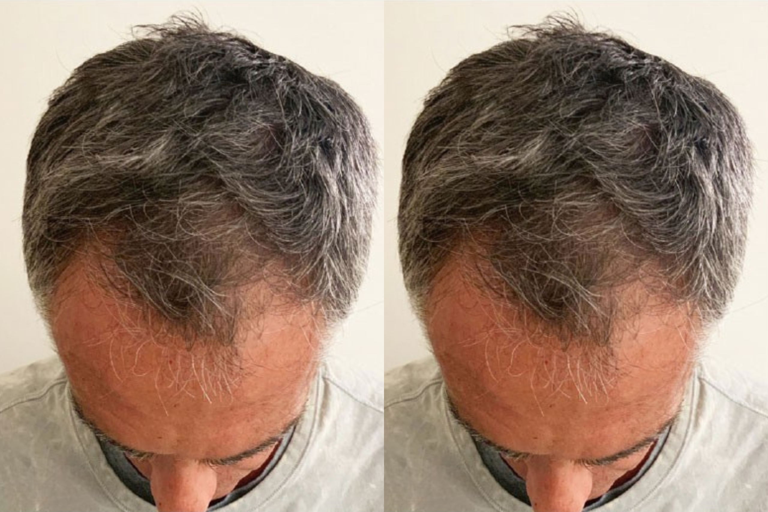 After image